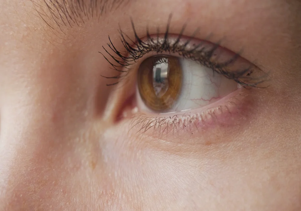  علامات وجود ماء في العين