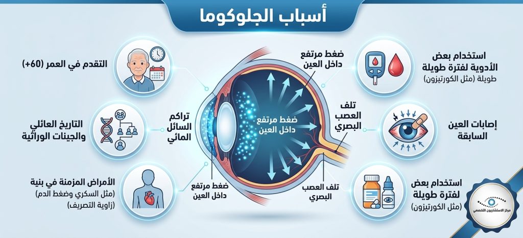 صورة توضح اهم اسباب الجلوكوما